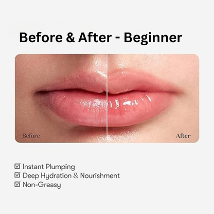 [بكج من عبوتين] مجموعة VT COSMETICS Reedle Shot لتكبير وترطيب الشفاه - صنع في كوريا وارد اليابان (منتج أصلي)