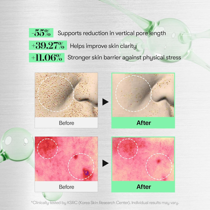 [بكج من عبوتين ] كريم CICA Reedle Shot من VT Cosmetics - صنع في كوريا وارد اليابان