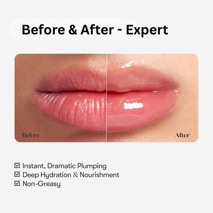 [بكج من عبوتين] مجموعة VT COSMETICS Reedle Shot لتكبير وترطيب الشفاه - صنع في كوريا وارد اليابان (منتج أصلي)