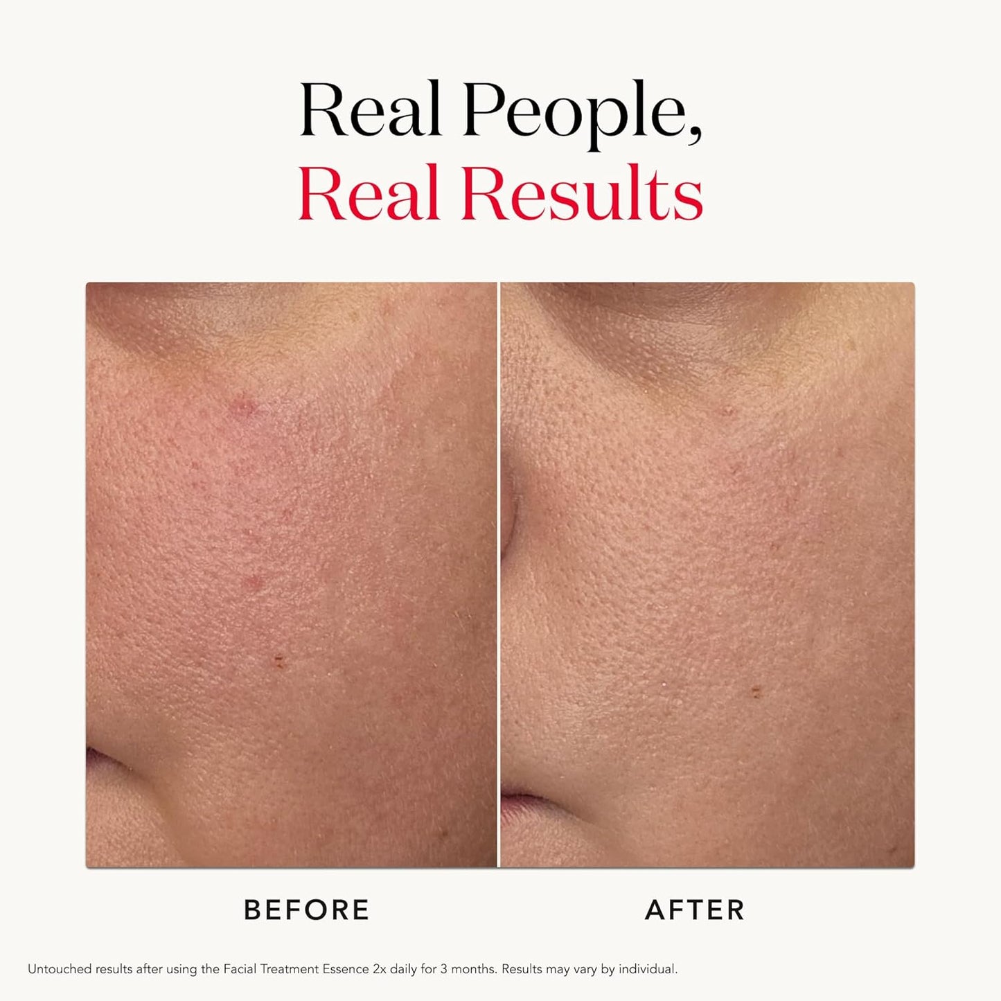 SK-II Facial Treatment Essence – معجزة Pitera™ للعناية العميقة وتجديد البشرة | إشراقة فورية + ترطيب 10 طبقات | يعالج الجفاف والمسام والخشونة | مثالي لكل أنواع البشرة | أحجام متعددة | صنع في اليابان