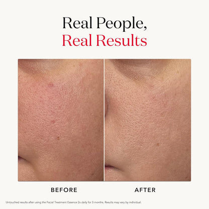 SK-II Facial Treatment Essence – معجزة Pitera™ للعناية العميقة وتجديد البشرة | إشراقة فورية + ترطيب 10 طبقات | يعالج الجفاف والمسام والخشونة | مثالي لكل أنواع البشرة | أحجام متعددة | صنع في اليابان